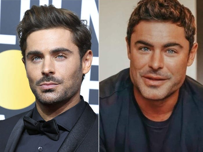 Zac Efron realmente fez uma cirurgia plástica? Aqui está a verdade