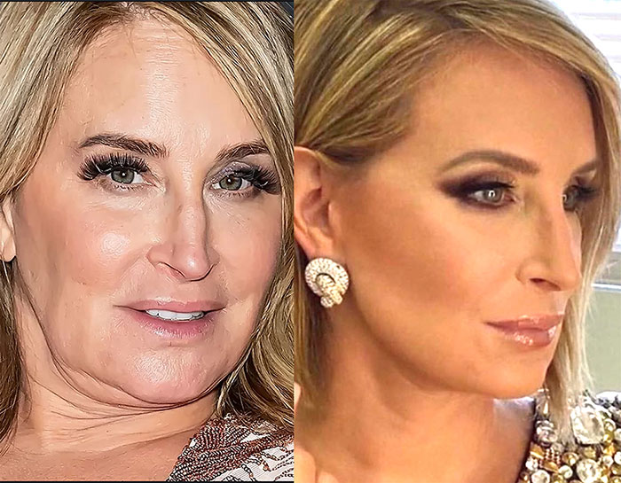14 celebridades que fizeram facelifts – e o que elas tinham a dizer sobre a cirurgia