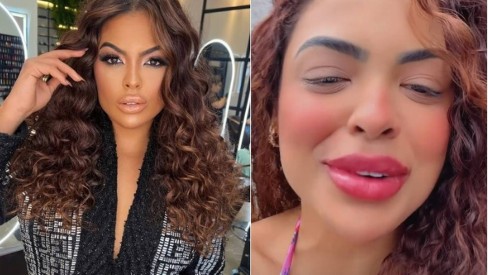 Harmonização facial e botox: o antes e depois de Paula e Bruno do BBB 23