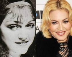 Madonna antes e depois da transformação