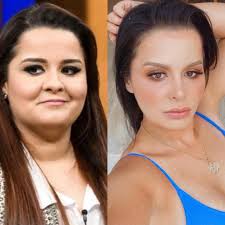 Rinoplastia Famosos: veja as celebridades que fizeram