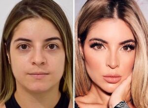 A Evolução Estética que Divide Opiniões