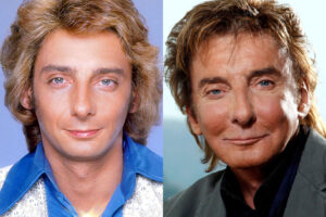 https://plasticadosfamosos.com.br/wp-content/uploads/2024/08/Barry-Manilow-e-a-Verdadeira-Historia-por-Tras-das-Cirurgias-Plasticas.jpeg