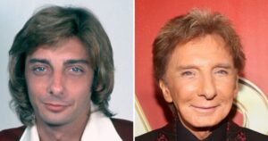 Barry Manilow e a Verdadeira História por Trás das Cirurgias Plásticas