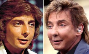 https://plasticadosfamosos.com.br/wp-content/uploads/2024/08/Barry-Manilow-e-a-Verdadeira-Historia-por-Tras-das-Cirurgias-Plasticas.jpeg