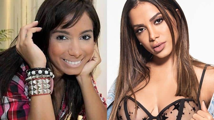 12 celebridades que fizeram plástica e você não sabia