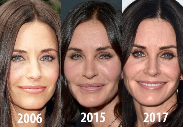 Courteney Cox e a Busca pela Beleza Eterna