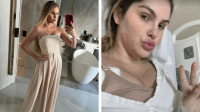 Bárbara Evans detalha novas cirurgias plásticas que realizou; saiba quais