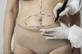 Por que não é indicado fazer lipo para emagrecer?