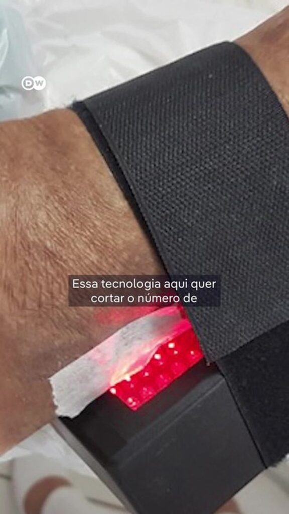 Tecnologia brasileira visa reduzir número de amputações por diabetes