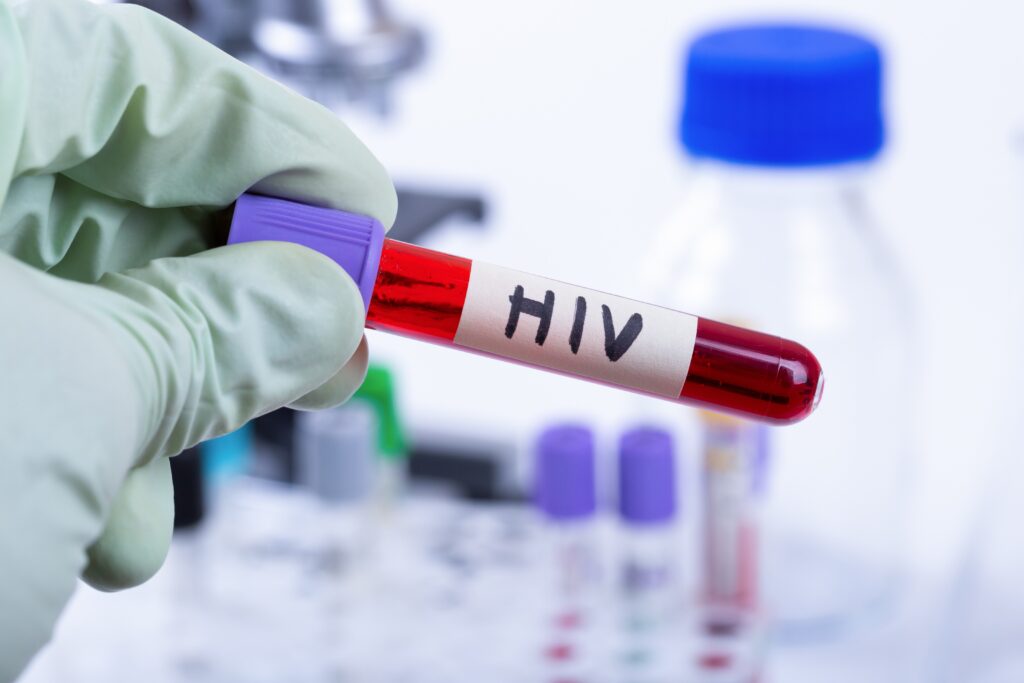 Brasil elimina transmissão vertical do HIV e registra queda na Aids e na mortalidade, mas novos casos do vírus têm leve alta, aponta boletim de 2025