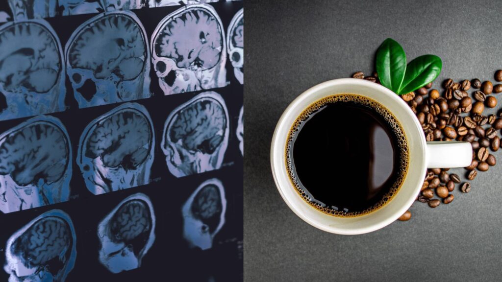 Café pode reduzir a chance de demência, diz estudo