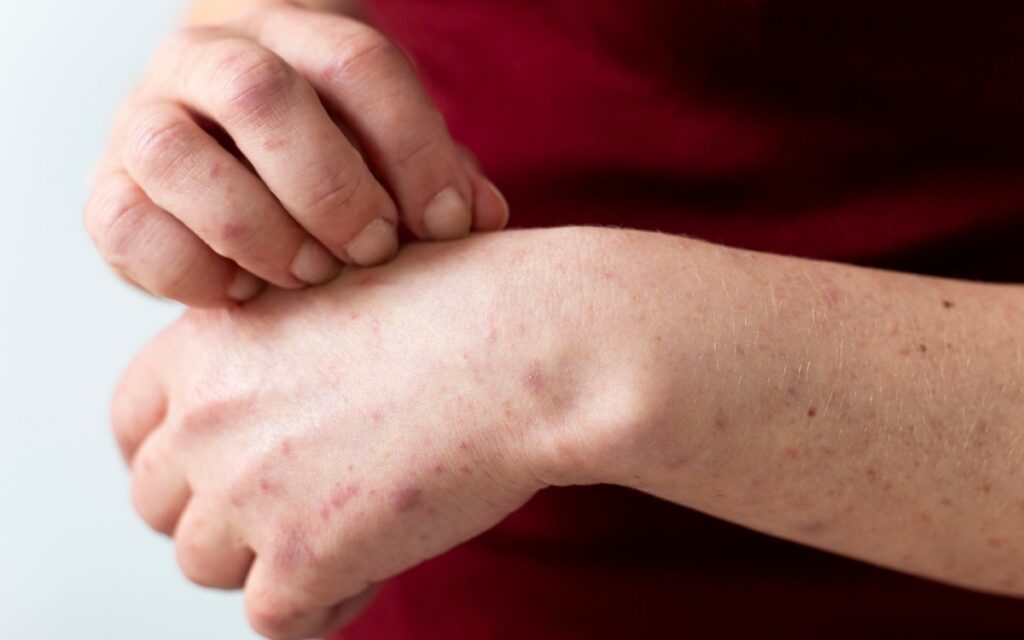 Cientistas descobrem que sistema imune ‘rouba’ DNA de células morrendo